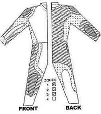 Injury risk zones